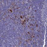 TYROBP Polyclonal Antibody