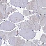 TYROBP Antibody in Immunohistochemistry (Paraffin) (IHC (P))