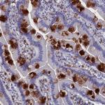 TYROBP Antibody in Immunohistochemistry (Paraffin) (IHC (P))