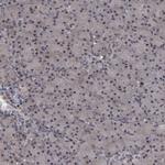 SAE1 Polyclonal Antibody
