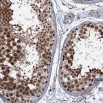 SAE1 Antibody in Immunohistochemistry (Paraffin) (IHC (P))