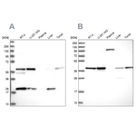 SAE1 Antibody in Western Blot (WB)