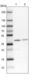 SAE1 Antibody in Western Blot (WB)