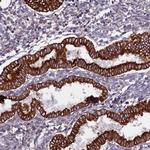 MEG2 Antibody in Immunohistochemistry (Paraffin) (IHC (P))