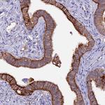 MEG2 Antibody in Immunohistochemistry (Paraffin) (IHC (P))