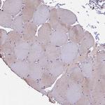 MEG2 Antibody in Immunohistochemistry (Paraffin) (IHC (P))