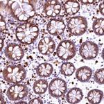 Flavin reductase Antibody in Immunohistochemistry (Paraffin) (IHC (P))