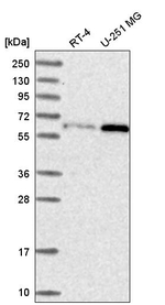 U2AF2 Antibody in Western Blot (WB)