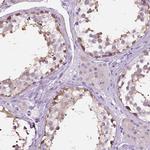 C20orf10 Antibody in Immunohistochemistry (Paraffin) (IHC (P))