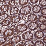 eIF3g Antibody in Immunohistochemistry (Paraffin) (IHC (P))