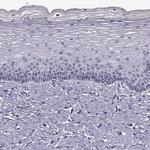 CRALBP Antibody in Immunohistochemistry (Paraffin) (IHC (P))