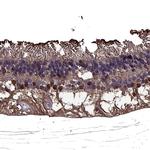 CRALBP Antibody in Immunohistochemistry (Paraffin) (IHC (P))
