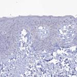 CPI-17 Polyclonal Antibody