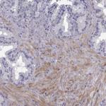 PDZRN4 Antibody in Immunohistochemistry (Paraffin) (IHC (P))