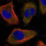 CEP170 Polyclonal Antibody