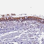 CEP170 Antibody in Immunohistochemistry (Paraffin) (IHC (P))