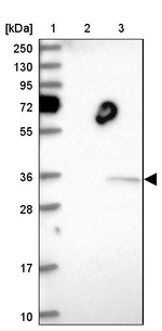 THAP11 Antibody in Western Blot (WB)