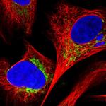 C18orf63 Polyclonal Antibody