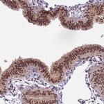TADA3L Antibody in Immunohistochemistry (Paraffin) (IHC (P))