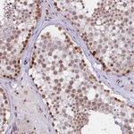 TADA3L Antibody in Immunohistochemistry (Paraffin) (IHC (P))