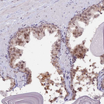 TADA3L Antibody in Immunohistochemistry (Paraffin) (IHC (P))