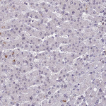 TADA3L Antibody in Immunohistochemistry (Paraffin) (IHC (P))