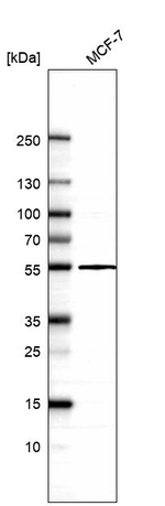 TADA3L Antibody in Western Blot (WB)