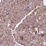 NDUFA9 Polyclonal Antibody