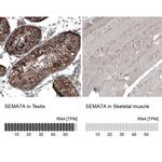 SEMA7A Antibody