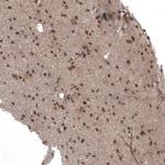 SEMA7A Antibody in Immunohistochemistry (Paraffin) (IHC (P))