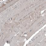 SEMA7A Antibody in Immunohistochemistry (Paraffin) (IHC (P))