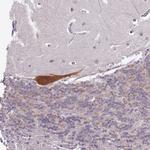 p130Cas Antibody in Immunohistochemistry (Paraffin) (IHC (P))