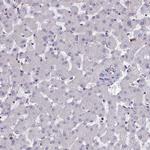p130Cas Antibody in Immunohistochemistry (Paraffin) (IHC (P))