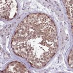 p130Cas Polyclonal Antibody