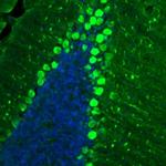 p130Cas Antibody in Immunohistochemistry (Paraffin) (IHC (P))