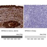 WFDC2 Antibody