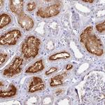 TMEM78 Polyclonal Antibody