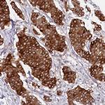 SLC39A6 Antibody in Immunohistochemistry (Paraffin) (IHC (P))