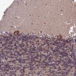 SLC39A6 Antibody in Immunohistochemistry (Paraffin) (IHC (P))