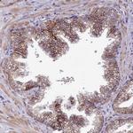 SLC39A6 Antibody in Immunohistochemistry (Paraffin) (IHC (P))