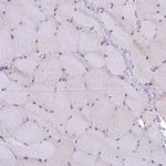 SLC39A6 Antibody in Immunohistochemistry (Paraffin) (IHC (P))