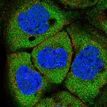 NCBP1 Polyclonal Antibody