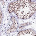 NCBP1 Antibody in Immunohistochemistry (Paraffin) (IHC (P))