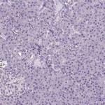 COL7A1 Antibody in Immunohistochemistry (Paraffin) (IHC (P))