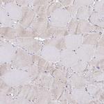 GALNS Polyclonal Antibody