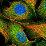 FAIM Polyclonal Antibody