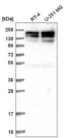 SYMPK Antibody in Western Blot (WB)