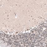 SETD2 Antibody in Immunohistochemistry (Paraffin) (IHC (P))