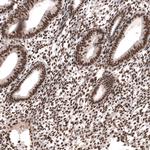 SETD2 Antibody in Immunohistochemistry (Paraffin) (IHC (P))