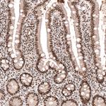 SETD2 Antibody in Immunohistochemistry (Paraffin) (IHC (P))